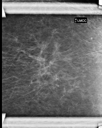radial scar spotmag lcc.jpg